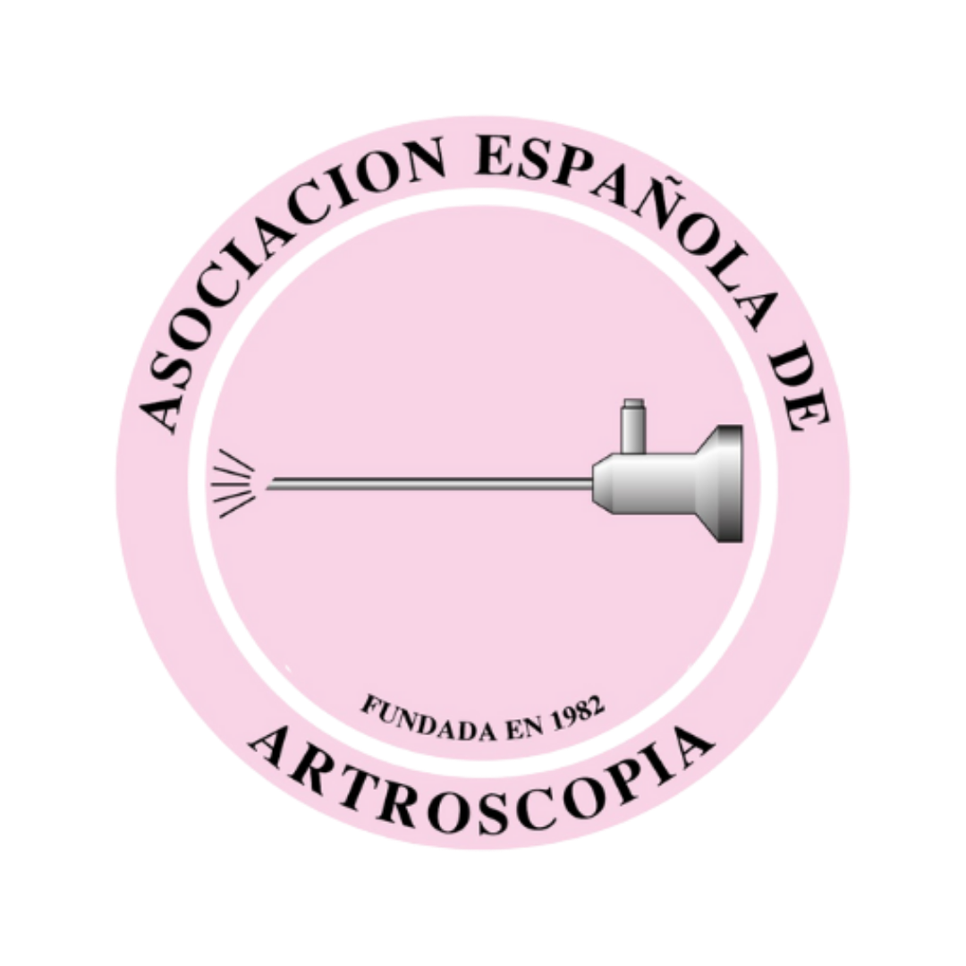 Endoscopia de columna en Marbella